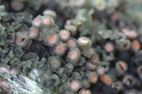 Image of skin lichen