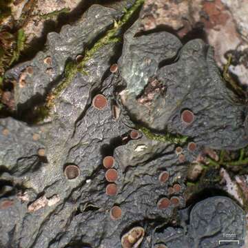 Image of skin lichen