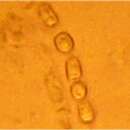 Plancia ëd Trichoderma nybergianum (T. Ulvinen & H. L. Chamb.) Jaklitsch & Voglmayr 2014