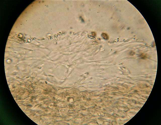 Image of Psilocybe ovoideocystidiata Guzmán & Gaines 2007