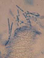 Image of Trichoderma