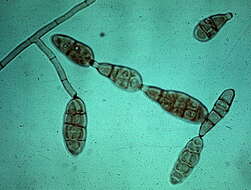 Image of Alternaria