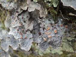 Image of lung lichen