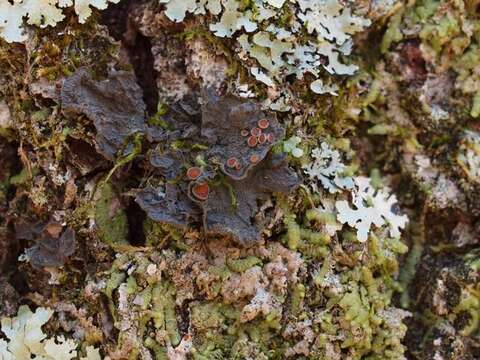 Image of skin lichen