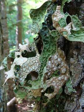 Image of lung lichen