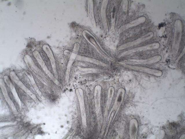 Image of Pertusaria multipuncta (Turner) Nyl.