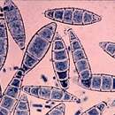 Imagem de Microsporum gypseum (E. Bodin) Guiart & Grigoraki 1928