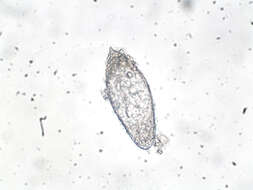 Image of Schistosoma haematobium