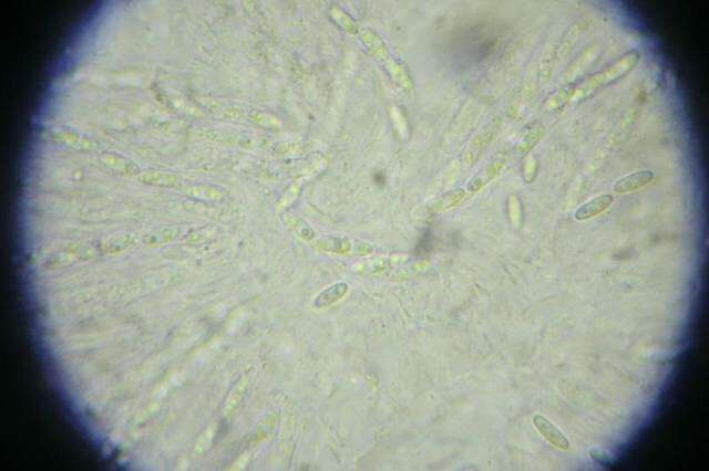 Image of Phomatosporales