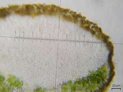 Image of Lecanoromycetidae