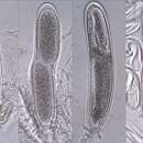 Слика од Pertusaria pustulata (Ach.) Duby