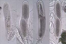 Imagem de Pertusaria pustulata (Ach.) Duby