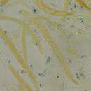 صورة Tatraea macrospora (Peck) Baral 1999