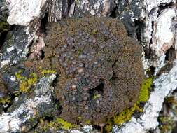 Image of skin lichen