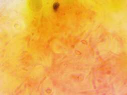 Image of Xanthomendoza