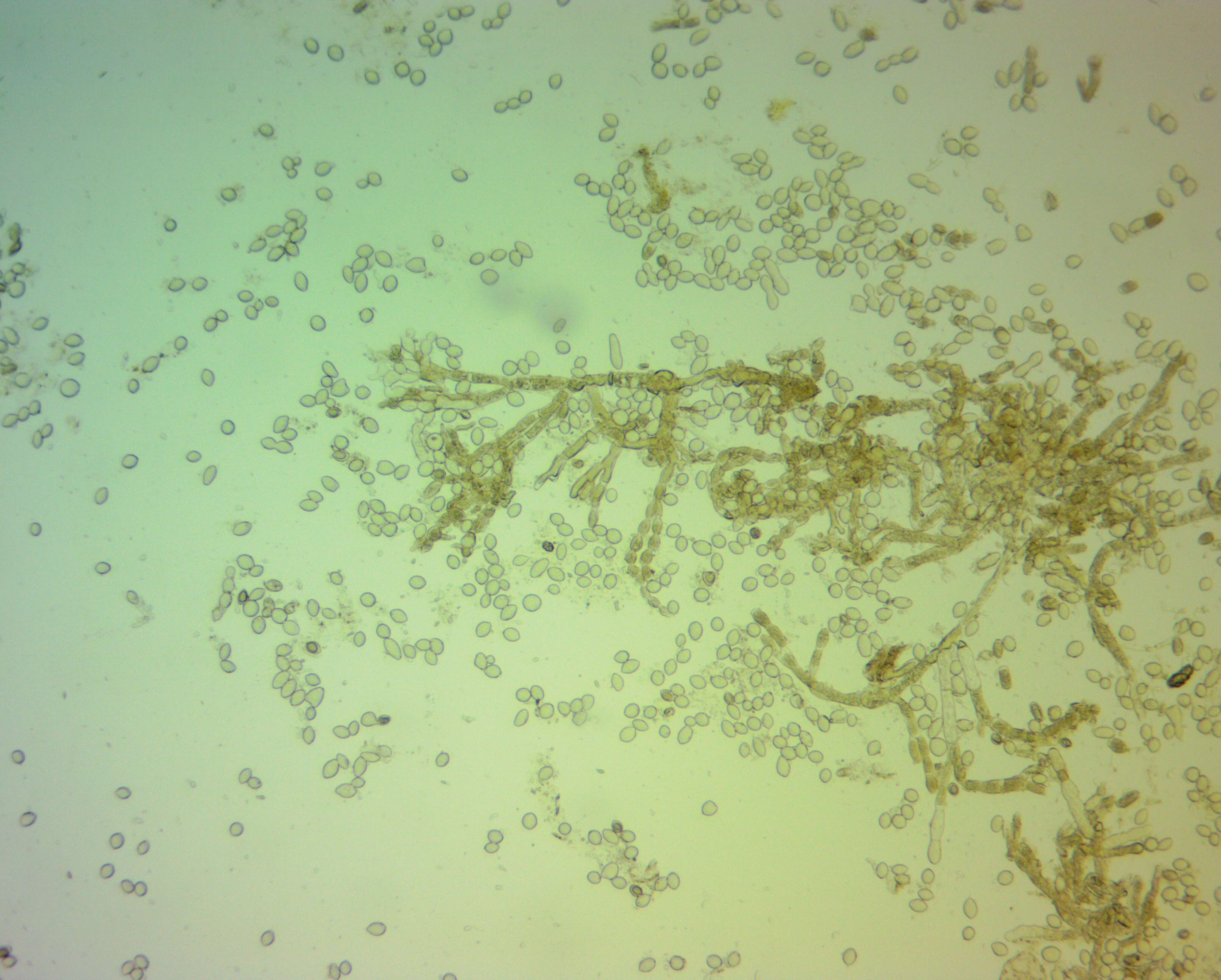 Sivun Monilinia fructicola (G. Winter) Honey 1928 kuva