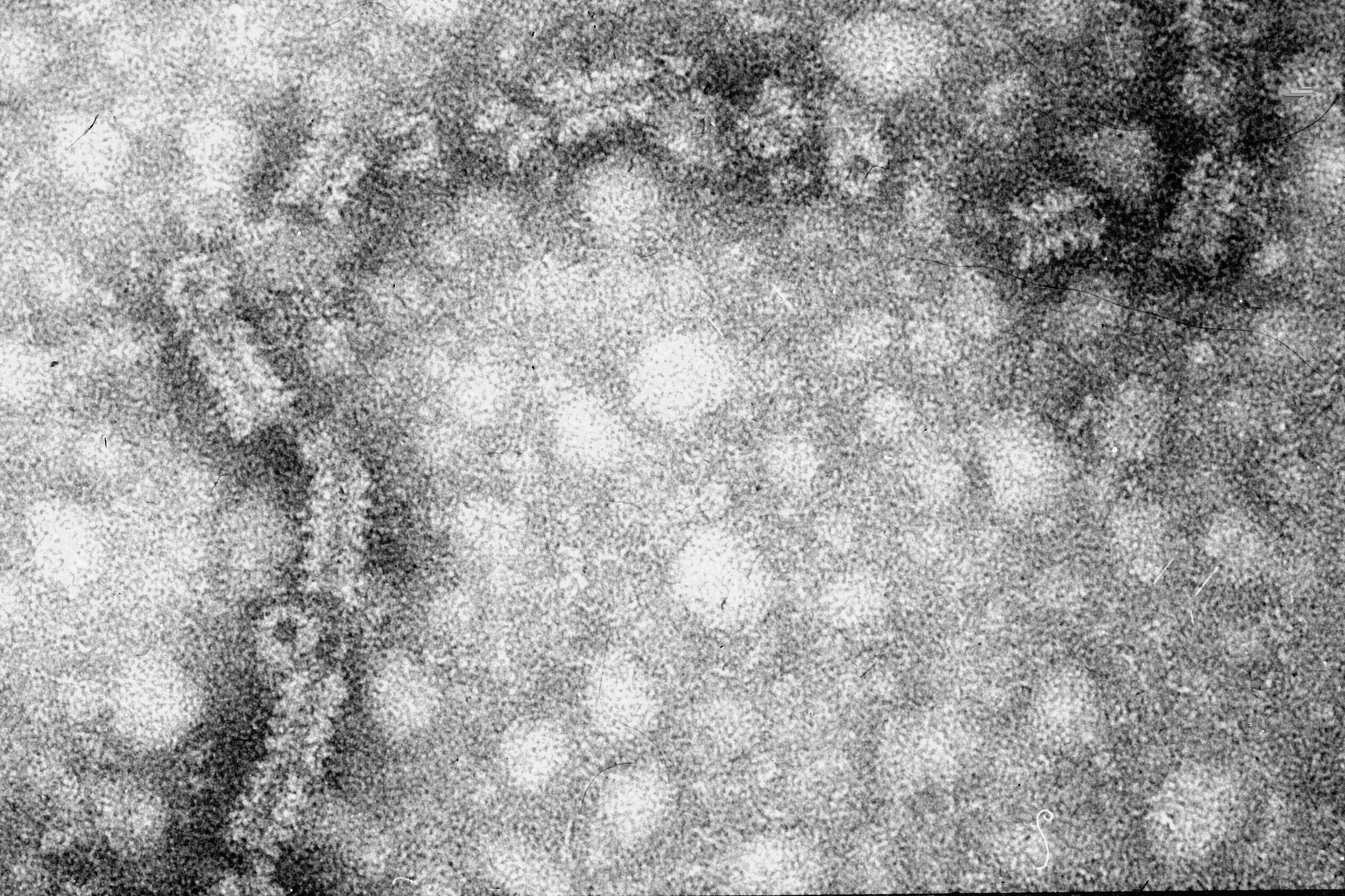 Image de Mumps rubulavirus