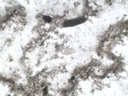 Image of Schistosoma mansoni