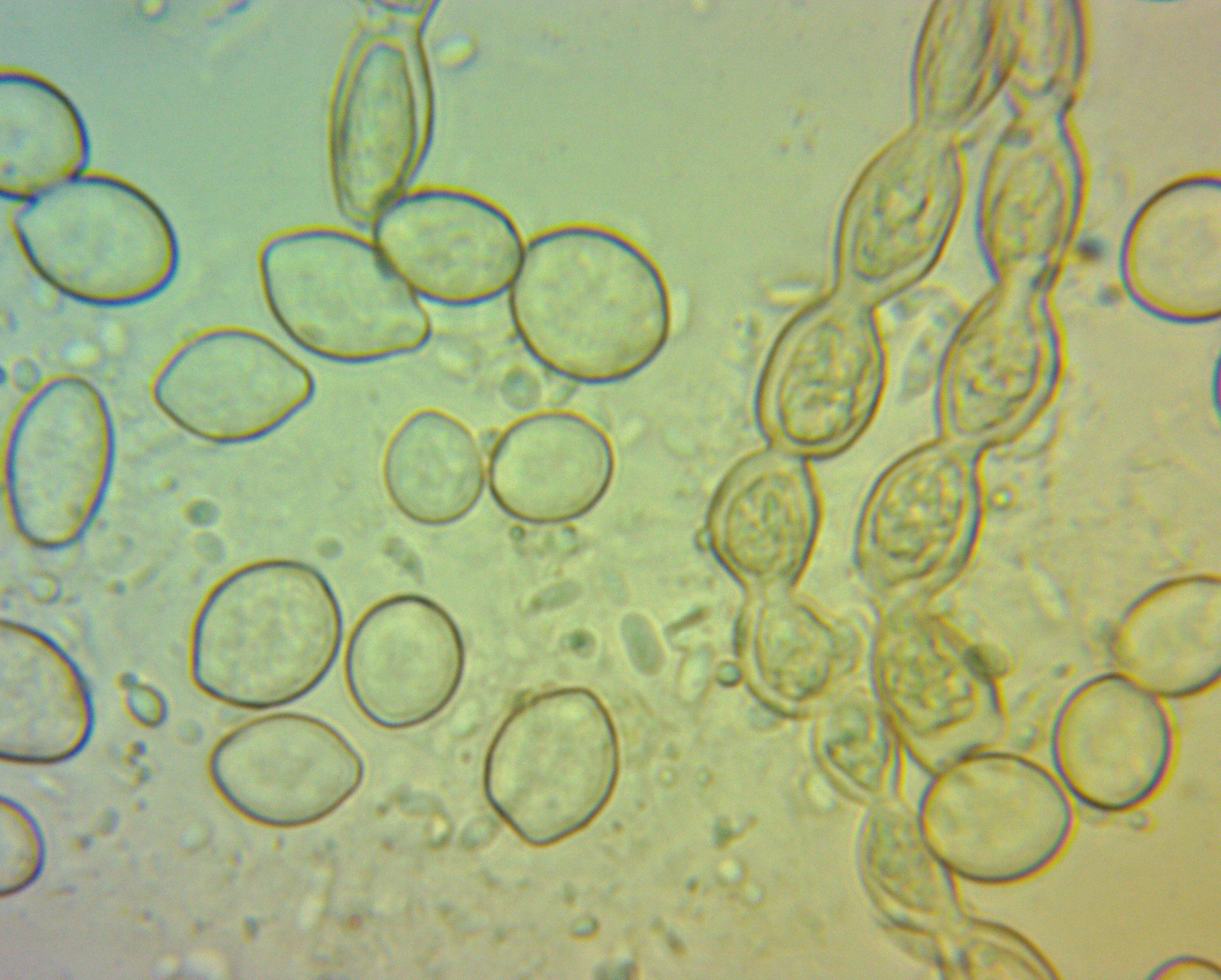 Sivun Monilinia fructicola (G. Winter) Honey 1928 kuva