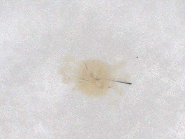 Image of Whirligig Mites