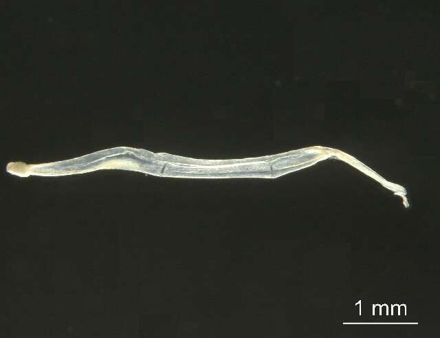 Image de Parasagitta elegans (Verrill 1873)