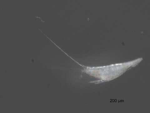 Image of Microsetella norvegica (Boeck 1865)