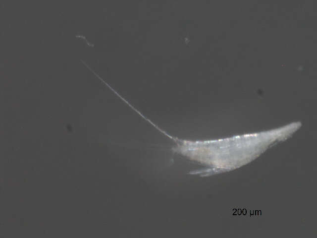 Image of Microsetella norvegica (Boeck 1865)