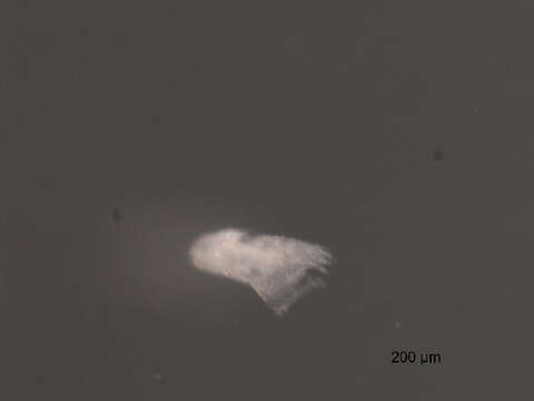 Image of Microsetella norvegica (Boeck 1865)