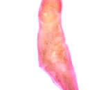 Image of Clinostomum