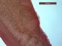 Image of Clinostomum