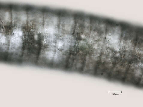 Image of <i>Lobocriconema warrenense</i>