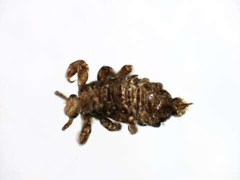 Image of human body louse