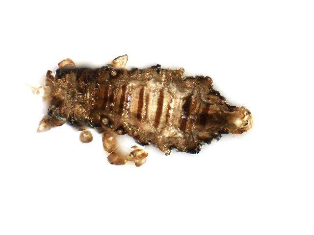 Image of human body louse