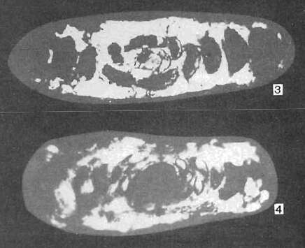 Image de Hemigordius calloviensis Lutova 1981