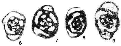 Neoseptaglomospiranella dainae (Lipina 1955) resmi