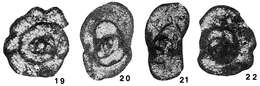 Image of Laxoseptabrunsiina valuzierensis Vachard 1977