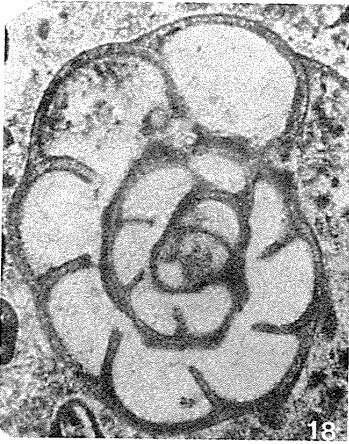 Image of Semiendothyra surenica Reitlinger 1980