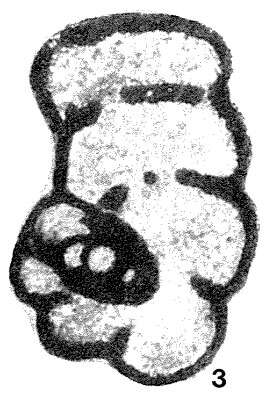 Image of Mikhailovella gracilis (Rauzer-Chernousova 1948)