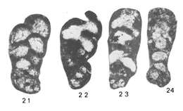 Globispiroplectammina mameti Vachard 1977的圖片