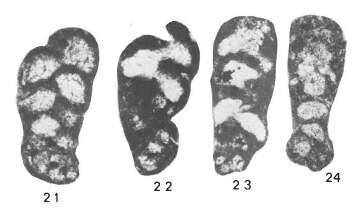 Image de Globispiroplectammina mameti Vachard 1977