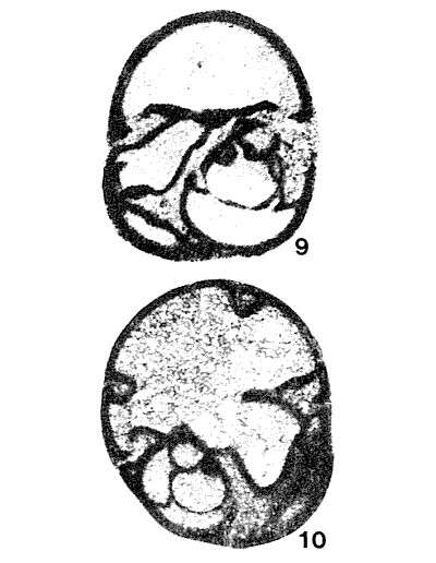 Image of Paraglobivalvulina mira Reitlinger 1965