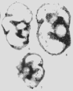 Spinotournayellina costifera Wu ex Wu & Liao 2001的圖片