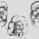 Image de Pseudoinflatoendothyra ovalis Wu ex Wu & Liao 2001