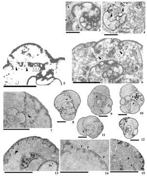 Image de Janischewskina brigantiensis (Cózar & Somerville 2006)