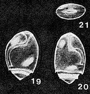 Image of Metalingulina belluliformis McCulloch 1977