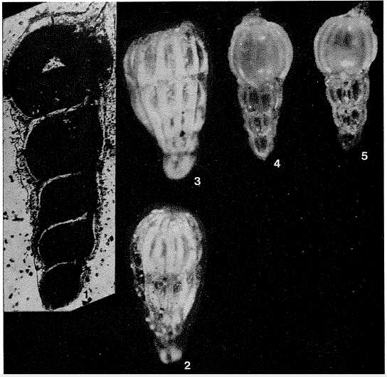 Image of Marginulinita dilatata Kuznetsova 1972