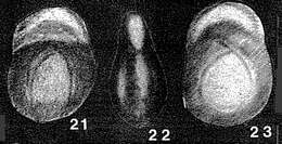 Image of Pseudopolymorphinoides limburgensis van Bellen 1946