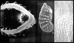 صورة Percultazonaria subaculeata (Cushman 1923)