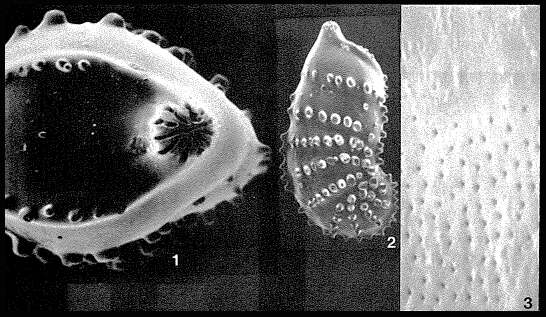 Image of Percultazonaria subaculeata (Cushman 1923)