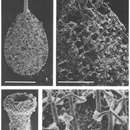 Image of Nanosylvanella palmulina Patterson 1990